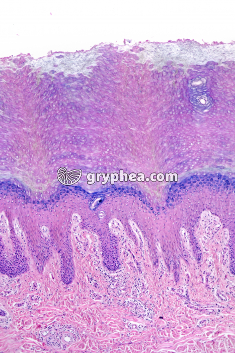 Peau plantaire CT x25 - gryphea.org